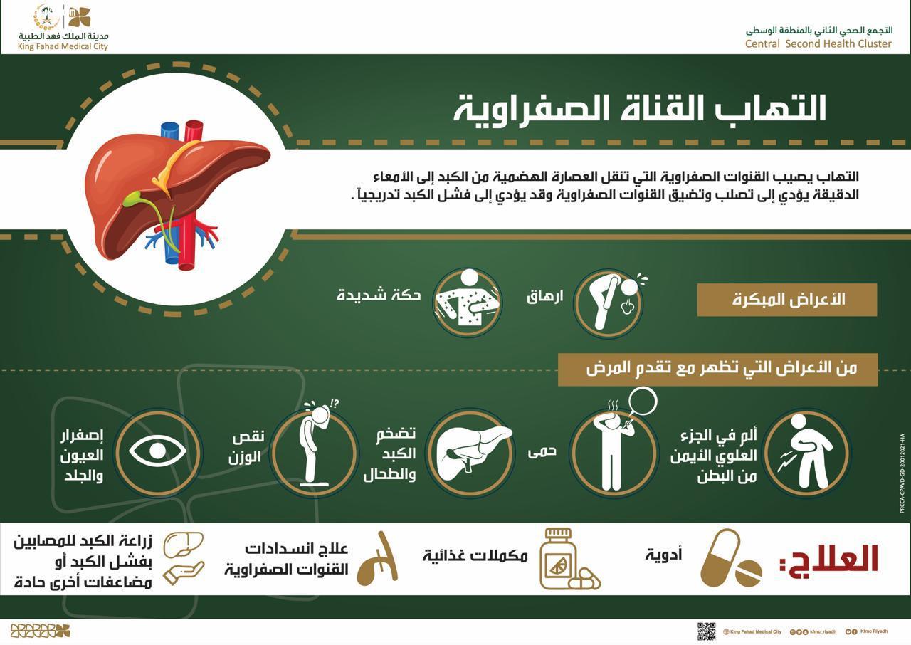 التهاب القنوات الصفرواية قد يؤدي لفشل الكبد 