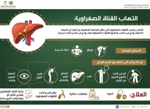التهاب القنوات الصفرواية قد يؤدي لفشل الكبد 